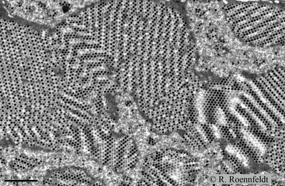 Part�culas de virus iridiscente en un cop�podo (Gladioferens pectinatus)