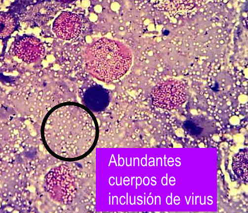 Presencia de cuerpos de inclusi�n de nucleopoliedrovirus en una frotis de tejidos larvarios