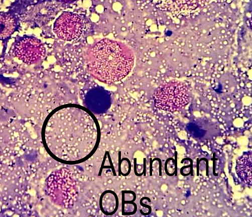 Microscope image of virus occlusion bodies from a smear of larval tissues